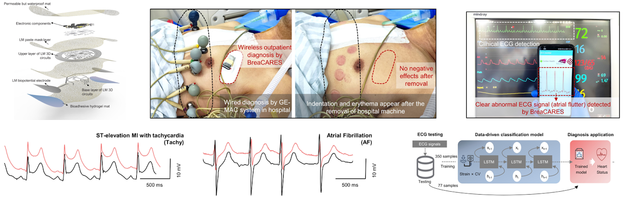 An ICU-grade breathable cardiac electronic skin for health, diagnostics, intraoperative and postoperative monitoring