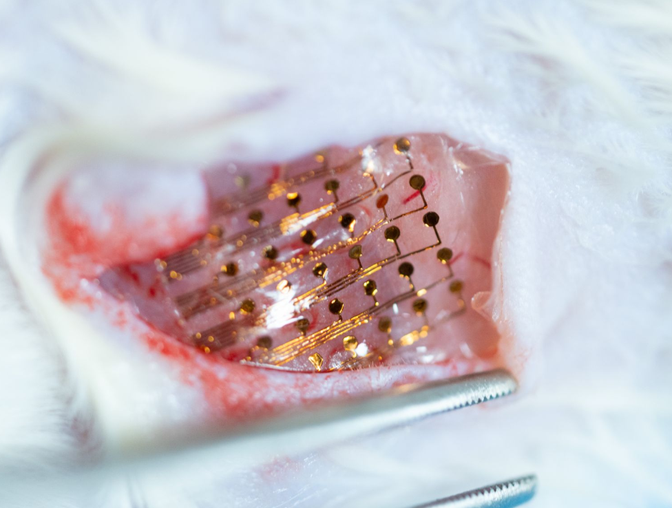 Implantable bioelectronics 1
